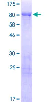 SDS-PAGE - Recombinant Human Synapsin III protein (AB159969)