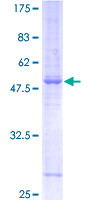 SDS-PAGE - Recombinant Human Synaptogyrin 2 protein (GST tag N-Terminus) (AB132194)