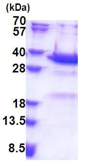 SDS-PAGE - Recombinant Human Synaptotagmin V protein (His tag N-Terminus) (AB171492)