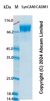 SDS-PAGE - Recombinant Human SynCAM/CADM1 Protein Standard (His tag) (AB323025)