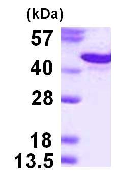 SDS-PAGE - Recombinant Human Syndecan-1 protein (His tag) (AB124600), expandable thumbnail