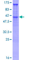 Recombinant Human Syndecan 2/HSPG protein