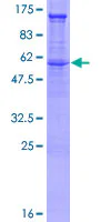 SDS-PAGE - Recombinant Human Syndecan 2/HSPG protein (GST tag N-Terminus) (AB132394)