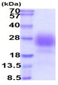 SDS-PAGE - Recombinant Human Syndecan 2/HSPG protein (His tag) (AB222986)