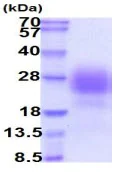 SDS-PAGE - Recombinant Human Syndecan 2/HSPG protein (His tag) (AB222986)