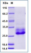 SDS-PAGE - Recombinant Human Syndecan 4 protein (His tag) (AB276298), expandable thumbnail