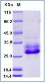 SDS-PAGE - Recombinant Human Syndecan 4 protein (His tag) (AB276298)