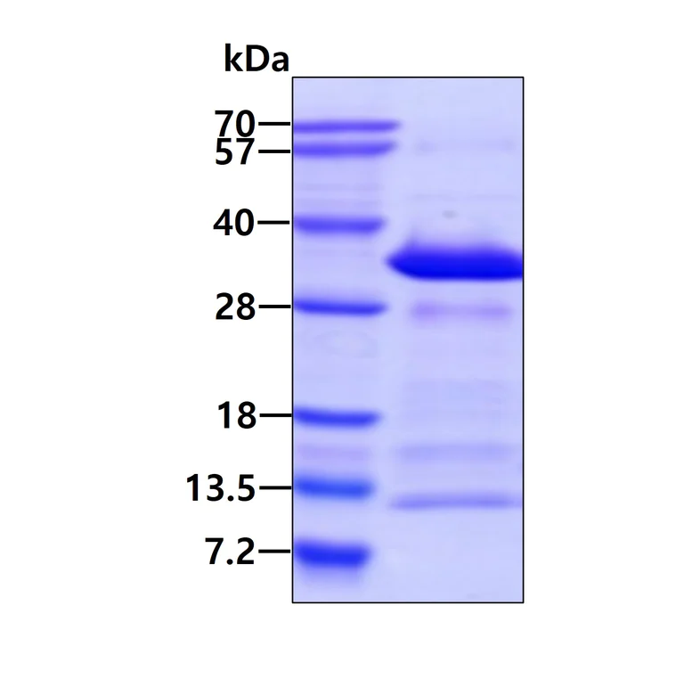 SDS-PAGE - Recombinant Human Syntaxin 12/Syntaxin-13 protein (His tag N-Terminus) (AB126666)