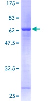 Recombinant Human Syntaxin-5 protein