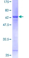 SDS-PAGE - Recombinant Human Syntaxin-5 protein (GST tag N-Terminus) (AB152715)