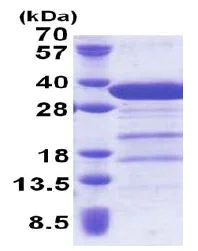 SDS-PAGE - Recombinant Human Syntaxin 6 protein (His tag N-Terminus) (AB171693)