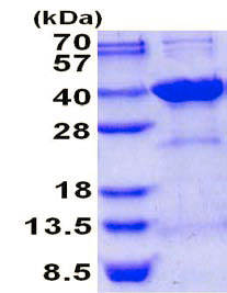 SDS-PAGE - Recombinant Human Syntenin 2 protein (AB137151), expandable thumbnail