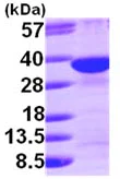 SDS-PAGE - Recombinant Human Syntenin protein (His tag N-Terminus) (AB101950)