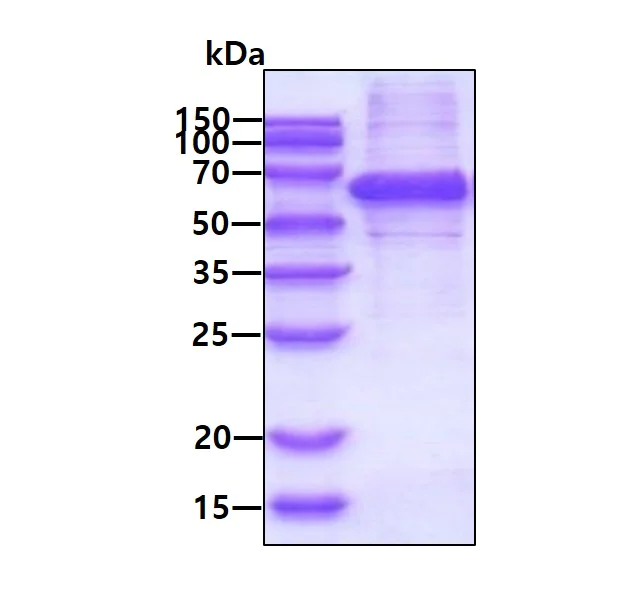 SDS-PAGE - Recombinant Human Syntrophin alpha 1 protein (AB116180)