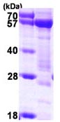 SDS-PAGE - Recombinant Human Syntrophin alpha 1 protein (AB116180), expandable thumbnail