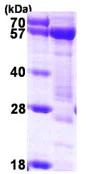 SDS-PAGE - Recombinant Human Syntrophin alpha 1 protein (AB116180)