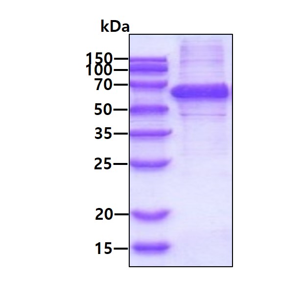SDS-PAGE - Recombinant Human Syntrophin alpha 1 protein (His tag N-Terminus) (AB116180)