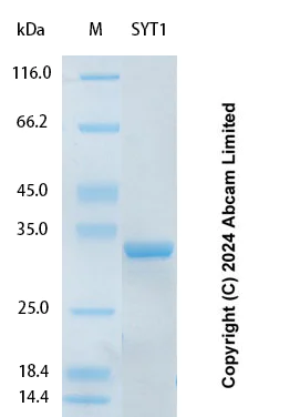 SDS-PAGE - Recombinant Human SYT1 Protein Standard (His tag) (AB323082)