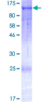Recombinant Human TAB3 protein