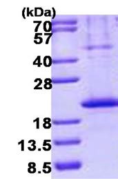 SDS-PAGE - Recombinant Human TACI protein (denatured) (AB140539), expandable thumbnail