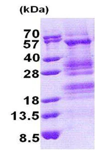 SDS-PAGE - Recombinant Human TADA3L protein (His tag N-Terminus) (AB171703)