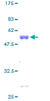 SDS-PAGE - Recombinant Human Tafazzin / TAZ protein (AB114664), expandable thumbnail