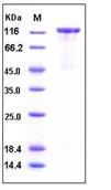 SDS-PAGE - Recombinant Human TAG1/TAX1 protein (His tag) (AB276272)