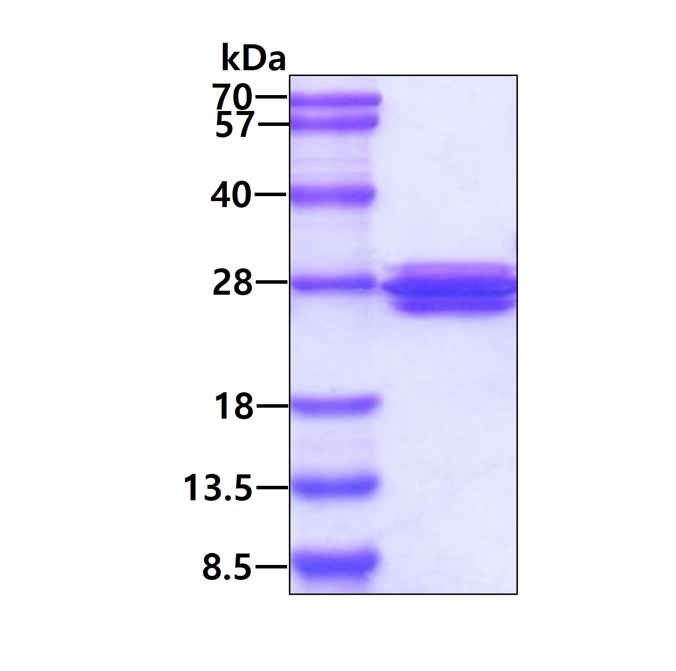SDS-PAGE - Recombinant Human TAGLN/Transgelin protein (AB101469), expandable thumbnail