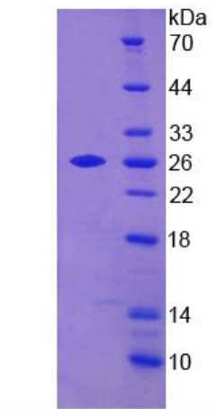 SDS-PAGE - Recombinant Human TAGLN2 protein (His tag) (AB275568)