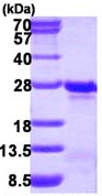 SDS-PAGE - Recombinant Human TAGLN3 protein (AB116179)