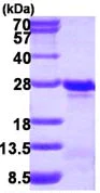 SDS-PAGE - Recombinant Human TAGLN3 protein (AB116179)