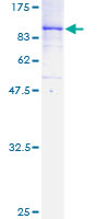 Recombinant human TAK1 protein