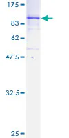 SDS-PAGE - Recombinant human TAK1 protein (GST tag N-Terminus) (AB132950)