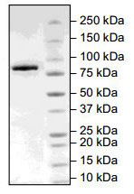 SDS-PAGE - Recombinant human Tankyrase 2/TNKS2 protein (AB198755), expandable thumbnail