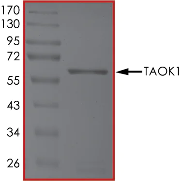 SDS-PAGE - Recombinant human TAOK1 protein (AB63169)
