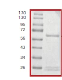 SDS-PAGE - Recombinant human TAOK2 protein (AB61426)