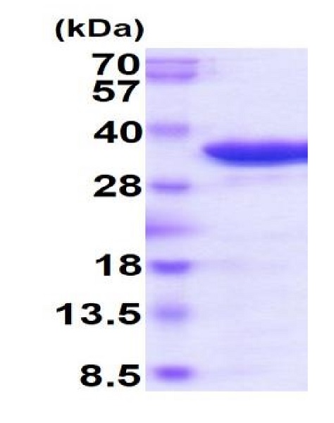 SDS-PAGE - Recombinant human Tartrate Resistant Acid Phosphatase protein (Active) (AB222972), expandable thumbnail