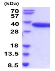 SDS-PAGE - Recombinant Human Tartrate Resistant Acid Phosphatase protein (AB206785)