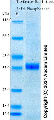 SDS-PAGE - Recombinant Human Tartrate Resistant Acid Phosphatase Protein Standard (His tag) (AB316704)