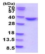SDS-PAGE - Recombinant Human TATDN1 protein (His tag) (AB202214)