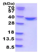 SDS-PAGE - Recombinant Human TATDN1 protein (His tag) (AB202214)