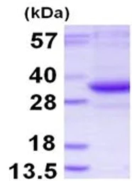 SDS-PAGE - Recombinant Human TATDN3 protein (AB126654)