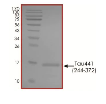 SDS-PAGE - Recombinant Human Tau (biotinylated ) protein (AB269000)