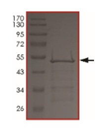 SDS-PAGE - Recombinant Human Tau (mutated N352H) protein (AB190399), expandable thumbnail