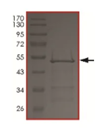 SDS-PAGE - Recombinant Human Tau (mutated N352H) protein (AB190399)
