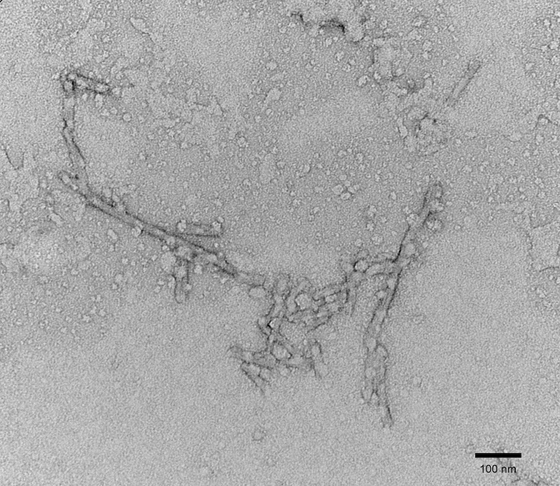 Electron Microscopy - Recombinant human Tau (mutated P301L) protein (Active) (AB256152)