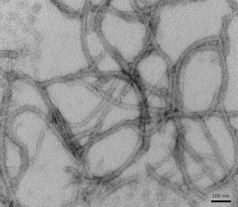 Electron Microscopy - Recombinant human Tau (mutated P301L) protein (Active) (Tag Free) (AB256152)