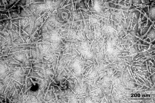 Electron Microscopy - Recombinant human Tau (mutated P301S) protein aggregate (Active) (AB246003)
