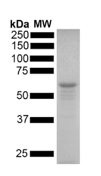 SDS-PAGE - Recombinant human Tau (mutated P301S) protein monomer (Active) (AB256153)