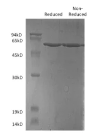 SDS-PAGE - Recombinant Human Tau protein (AB199583)